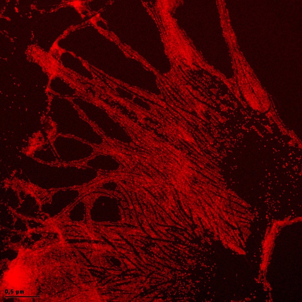 Nanopartículas metálicas coloidales