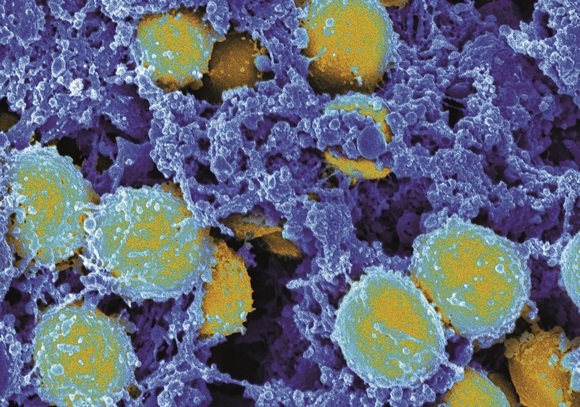 Staphylococcus aureus