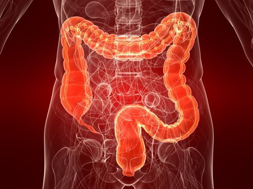 1-colitis