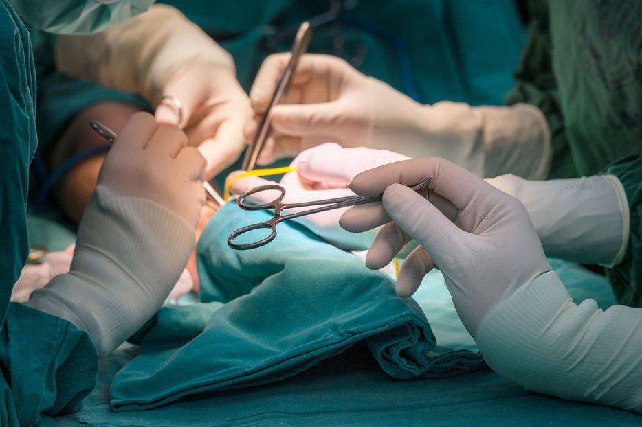 scrub nurse give surgical tool to surgeon