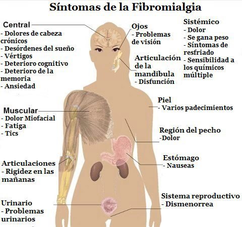 La fibromialgia es una neuropatía que ataca más a las mujeres