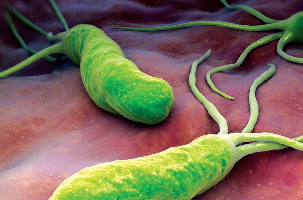 Desde úlceras hasta cáncer gástrico causa el helicobacter pylori